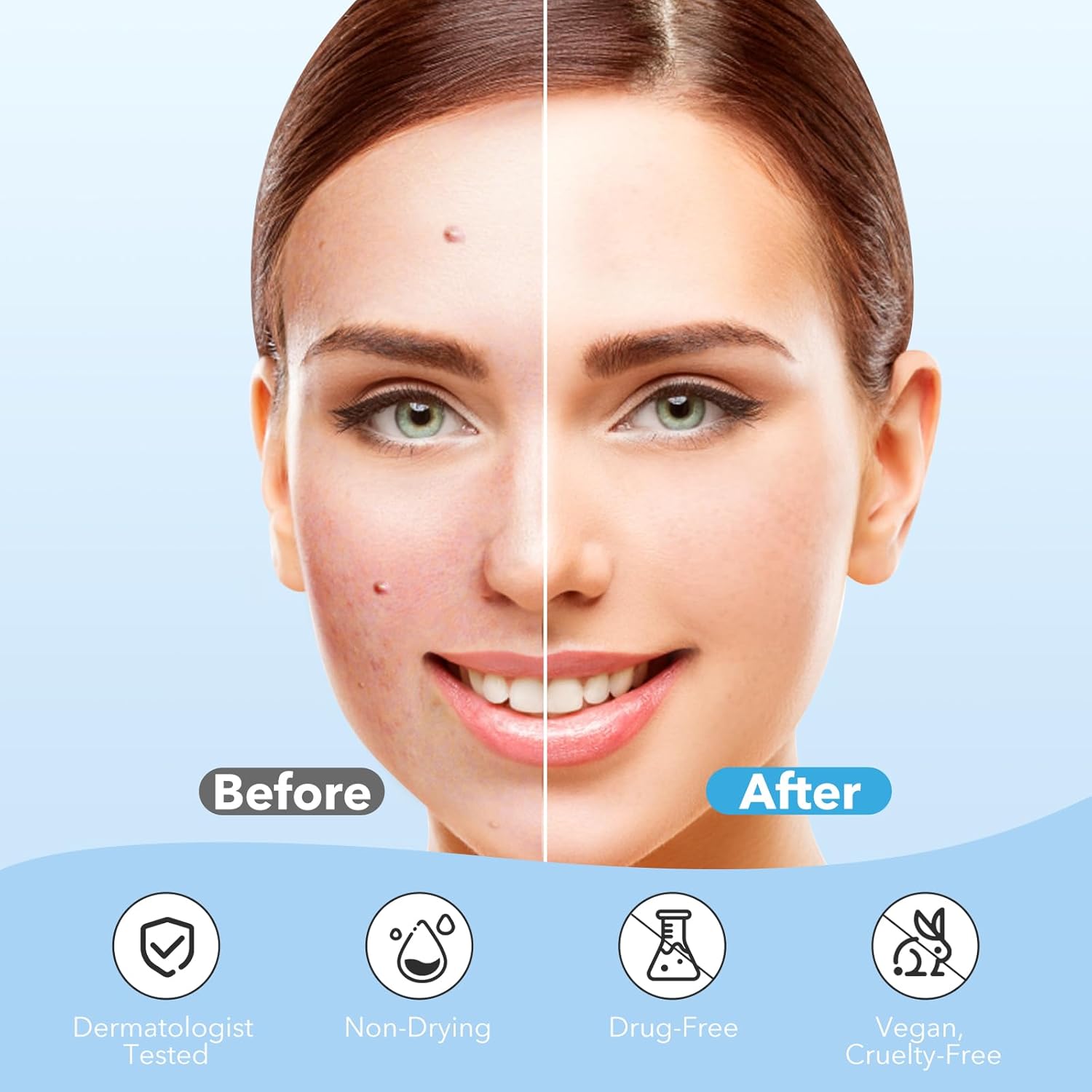 PIMPLE PATCHES | HYDROCOLLOID PATCHES