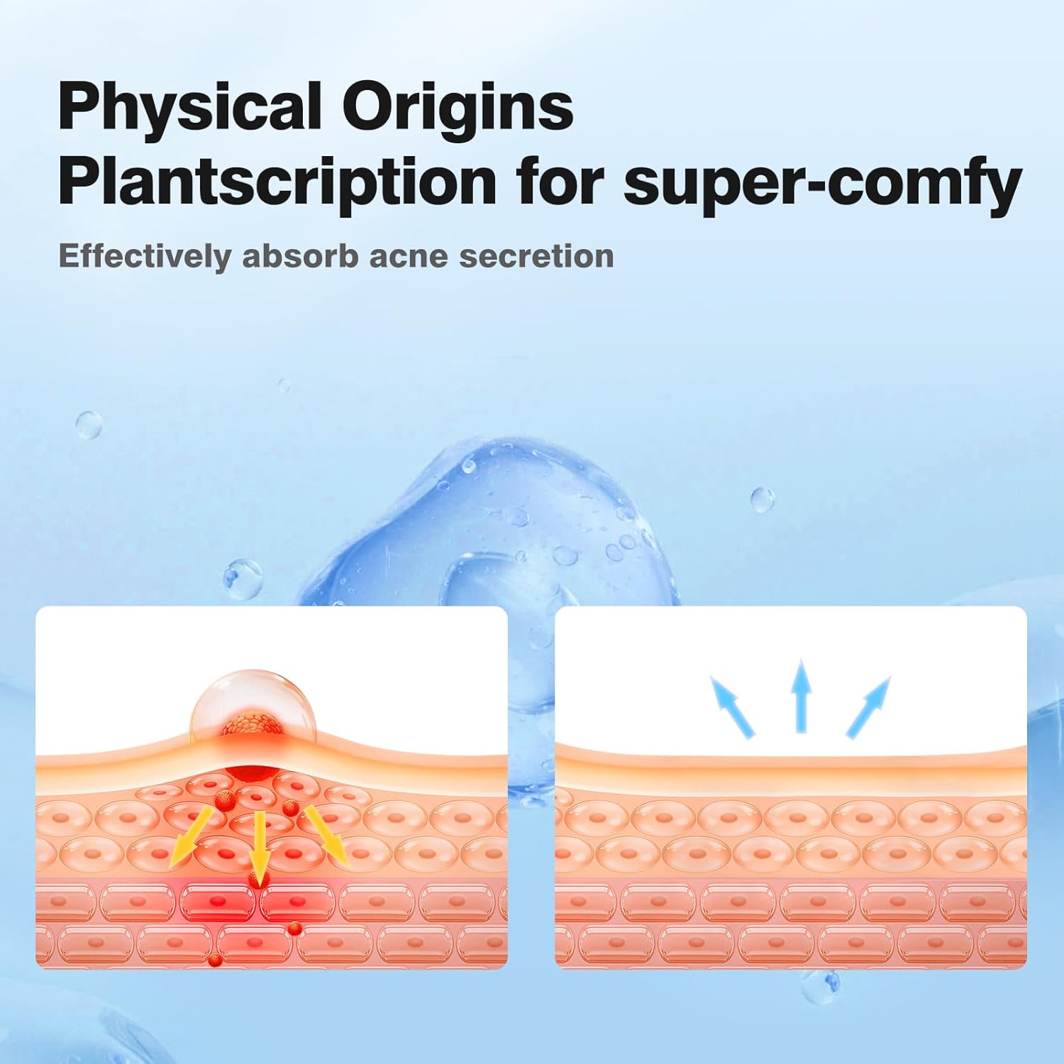 PIMPLEPATCH® - Hydrocolloid Stars