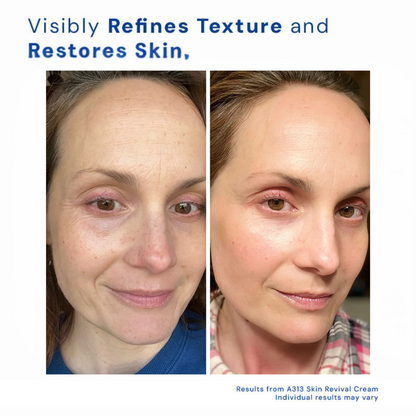 Retox® Skin Revival Botox Cream