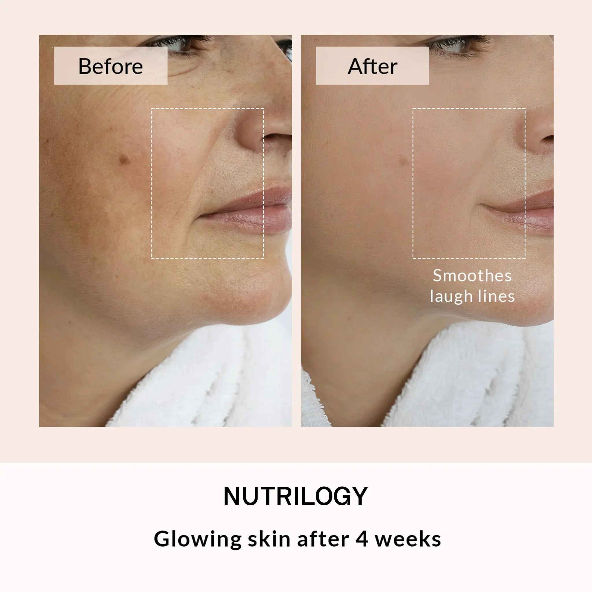 SKINGLOW® - Face & Neck Mask